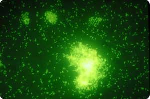 bacteriasm.thumb.jpg.46435911a3a2da8f559aa816f36a488b.jpg
